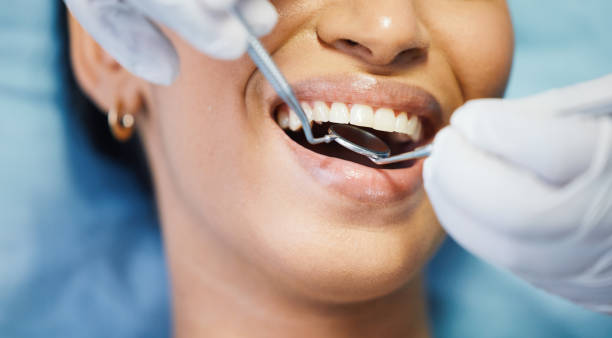 Best Emergency Tooth Extraction in Alvord, TX