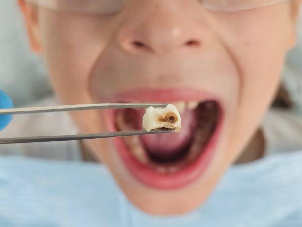 Best Weekend Emergency Dentist in Alvord, TX