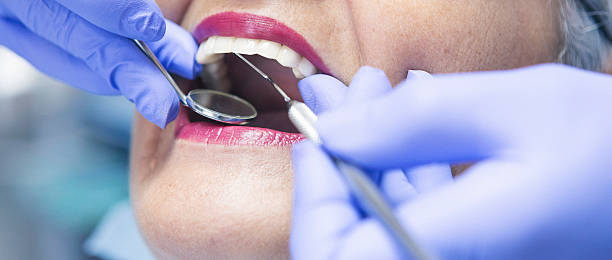 Best Emergency Treatment for Dental Infections or Abscesses in Alvord, TX
